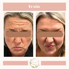 Mallorie Dammeyer, APRN