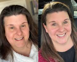 Struggling with Skin Issues? We've Got You Covered! Whether you're dealing  with cystic or hormonal acne, sagging skin, fine lines and wrinkles,  eczema, rosacea, psoriasis, rashes, sunburn or sun damage, scars, or