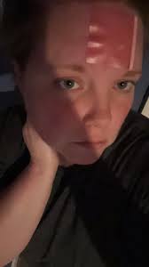 X39 Patch for Pain Relief and Wellness