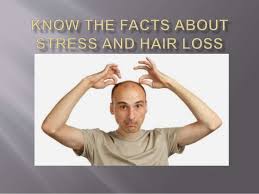 Has hair loss stolen a bit of your confidence? Male Pattern Baldness Natural Treatment Option For Men
