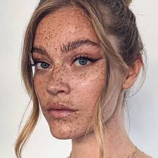 Image result for Freckled skin