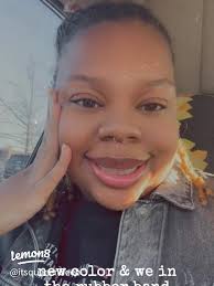 8 Months of Braces: My Journey with Color Changes and Rubber Bands