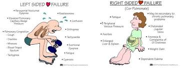 Your Daily Doze Of Mnemonics Left And Right Sided Heart