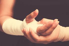 Image result for Short Arm Cast