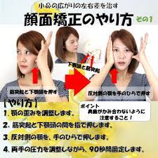 小鼻の広がりの左右差を治す顔面矯正のやり方 その１ 顔の歪み 治す 顎 歪み