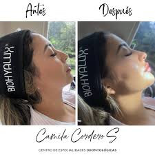 Camila Cordero Cuenca