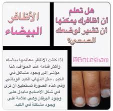 كيف تعبر الاظافر عن وضعك الصحي الأظافر البيضاء إذا كانت الأظافر معظمها بيضاء وأكثر قتامه عند الحواف هذا مؤشر إلى وجود مشاكل في ال Health Tips Health Medical
