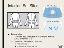 image result for insulin pump site rotation chart type 1