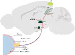 Image result for Eye Rest Green 1983 Hussmann