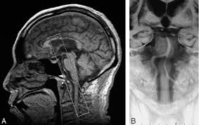 American Journal of Neuroradiology