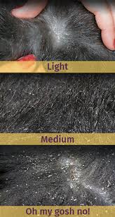 Image result for what do Cheyletiella look like in dog fur