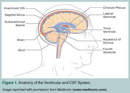 Normal Pressure Hydrocephalus In The Older Patient Consultant360