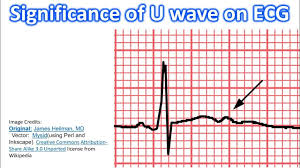 Image result for U Wave