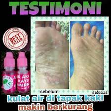 Jom.rawat dengan air akar kayu dan pastikan original. Amirna Multipose Water Ubat Sakit Kuku Resdung Dan Penyakit Yang Berkaitan Dengan Kulit Shopee Malaysia