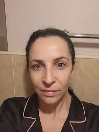 Wicklow woman praises 'silky smooth' cleansing balm for helping her acne  and sensitive skin