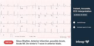 Get in the zone and make it count, with a social platform and gamification to keep you feeling good, inside and out. Instaecg Free Instant Ecg Interpretation On Windows Pc Download Free 1 0 0 Com Tricog Ftop