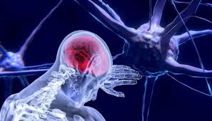 Es una enfermedad neuromuscular de progresión rápida, que lleva a la perdida de la fuerza muscular generalizada. Loy3qpbur2zplm