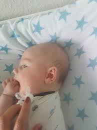 Der schön gerundete hinterkopf ist für die entwicklung des säuglings ein echtes plus. Kopfverformung Marz 2017 Babyclub Seite 2 Babycenter