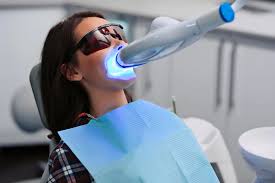 Teeth Whitening Services | Great Expressions Dental