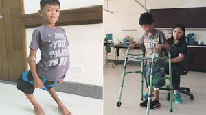 Image result for Pediatric Leg Disorder