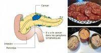 14 Aliments Cancerigenes Que Vous Ne Devriez Plus Jamais Mettre Dans Votre Bouche Aliments Contre Le Cancer Sante Nutrition Alimentation