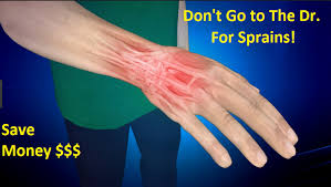 Although wrist sprains and fractures have many of the same symptoms, there are a few telltale signs of a fracture to be aware of. Save Sprained Ankle Wrist Shoulder Injuries Follow This Simple Formula For Greatly Reduced Healing Time Steemit
