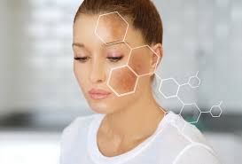 We did not find results for: Pigmentflecken Im Gesicht Tipps Info Volksversand Versandapotheke