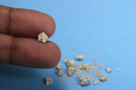 Le monohydrate se présente naturellement sous forme de whewellite minéral. Totul Despre Pietrele La Rinichi Cauze Simptome Tratament Secom Ro