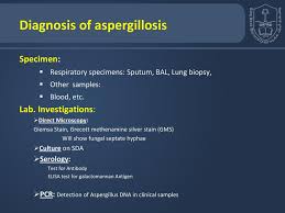 Diagnosing an infection caused by aspergillus mold can be difficult and aspergillus is common in the environment and is sometimes found in the saliva and sputum of. Lecturer Name Dr Ahmed M Albarrag Ppt Download
