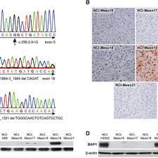 Check spelling or type a new query. Bap1 Alterations In Primary Mesothelioma Cells Chromatograms Showing Download Scientific Diagram