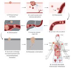 Comments for chapter chapter 22. Cancers Free Full Text Obesity And Cancer Metastasis Molecular And Translational Perspectives Html