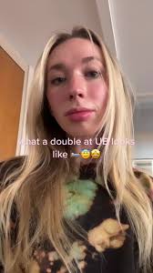 University of Buffalo Dewey Hall Dorms