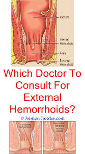 Is Witch Hazel Good For Hemorrhoids Hemorrhoids Treatment Bleeding Hemorrhoids Hemorrhoids