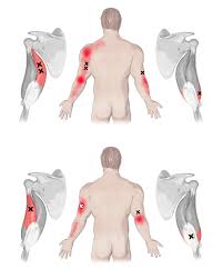 Triceps Brachii Muscle Yoganatomy