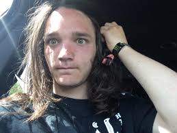 Dealing with sunburns after wrestling