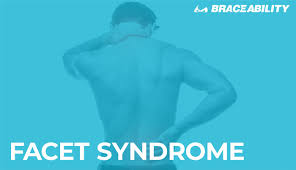 Facet Syndrome Lumbar Cervical Arthrosis Joint Pain