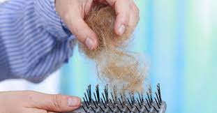 That is, if you see significantly more than 150 hairs in your hands, hairbrush or shower drain throughout the day, consider if you could have abnormal hair loss or androgenetic alopecia. Telogen Effluvium Symptoms Treatment And Recovery