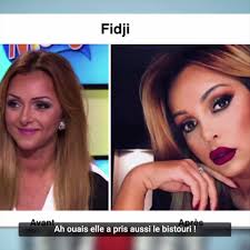 Il y a quelque chose qui a changé chez heidi montag pratt ! Sam Zirah Julien Guirado Juge Le Avant Apres Chirurgie De Maeva Ghenam Milla Facebook