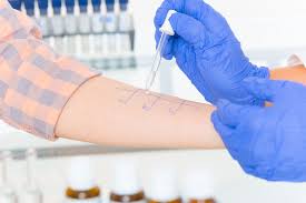 Allergietest Welcher Arzt Sie Macht Und Welche Es Gibt