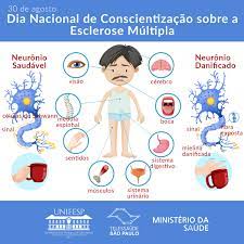 Esclerose múltipla a esclerose múltipla é uma doença autoimune que afeta o cérebro e a medula espinhal (sistema nervoso central). Telessaude Sao Paulo Unifesp 30 De Agosto Dia Nacional De Conscientizacao Sobre A Esclerose Multipla