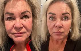 Skincare & Cosmetic Injections