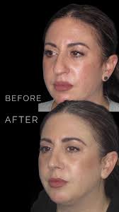 Anthony Corrado Naples Florida