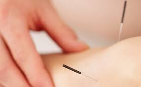 Zhengying Gb17 Nomenclature Location Functions Indications Acupuncture Nepal