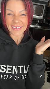 Fundraiser by Tara Brownlee : Help me get my smile back…