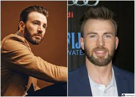 Chris Evans Hair Transplant Story