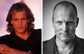 Mark slowly but surely embraces his balding, as well as his grey hairs. 19 Bald Celebrities Before After Embracing Baldness