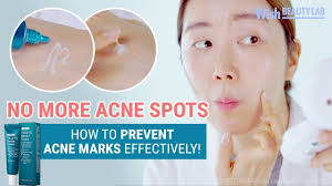 Pin On Skincare