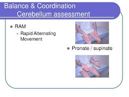 Image result for Rapid Alternating Movements