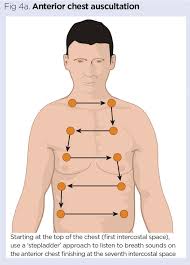 How To Perform Chest Auscultation And Interpret The Findings Nursing Times