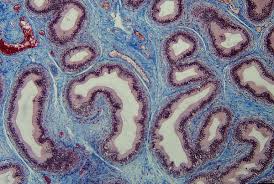 The types of connective tissue include cartilage, bone, collagen fibers, reticular fibers, elastic fibers, blood, hemopoietic/lymphatic, adipose tissue, bone marrow, and lymphoid tissue. Connective Tissue Wikipedia